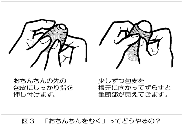 切れ チン 子 た 皮 の